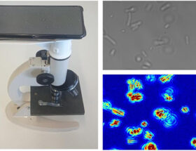 Test de sensibilité aux antibiotiques à l'aide d'un microscope simple et d'un smartphone