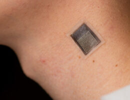 L'échographie portable mesure la rigidité des tissus sous la peau
