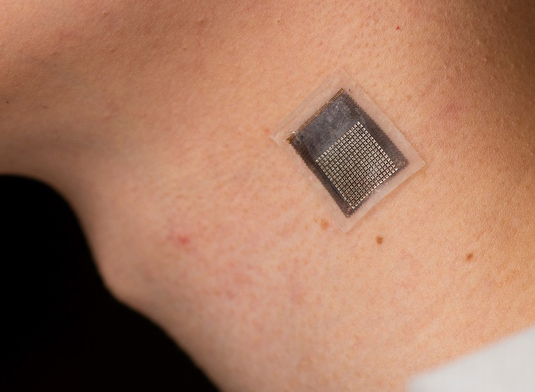 L'échographie portable mesure la rigidité des tissus sous la peau