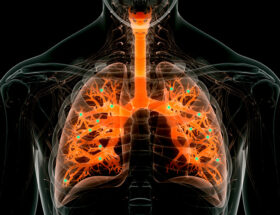 Les nanoparticules délivrent une thérapie par ARNm aux poumons