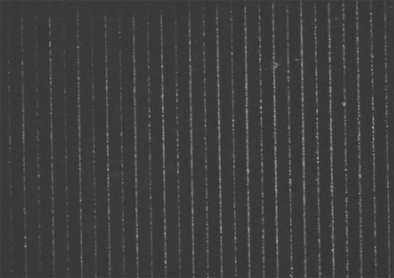 La puce microfluidique facilite le diagnostic de la tuberculose