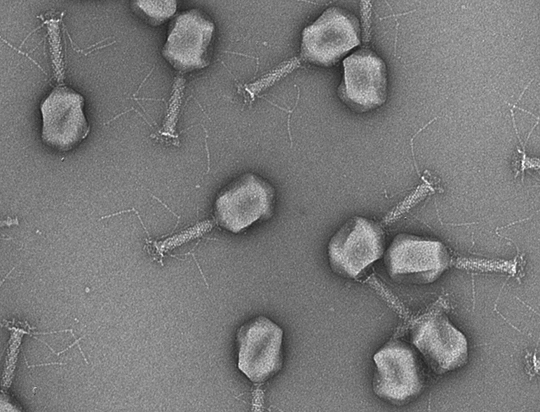 Bactériophages pour diagnostiquer et traiter les infections de la vessie