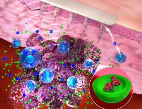 Le patch cutané à micro-aiguilles mesure les biomarqueurs du cancer