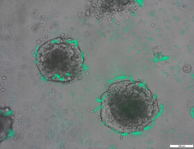 Les bactéries équipées de CRISPR détectent les tumeurs |  Medgadget