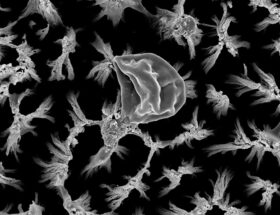 Les nanopillaires gravés tuent les bactéries et les champignons sur les implants en titane
