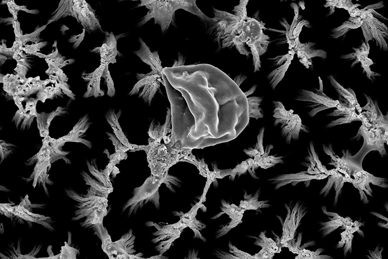 Les nanopillaires gravés tuent les bactéries et les champignons sur les implants en titane