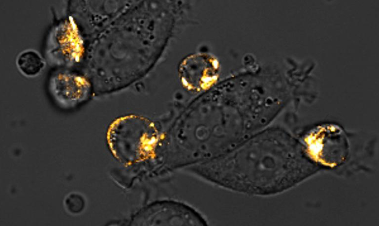 Les bactéries marquent les tumeurs avec des cellules T