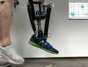 La cheville robotisée aide au contrôle postural chez les amputés
