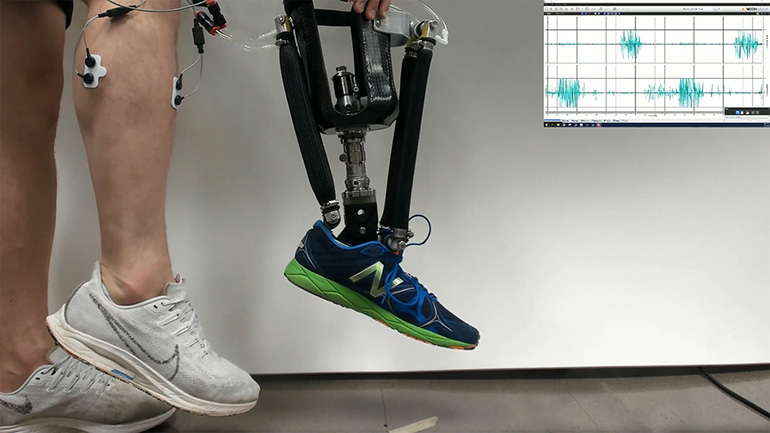La cheville robotisée aide au contrôle postural chez les amputés