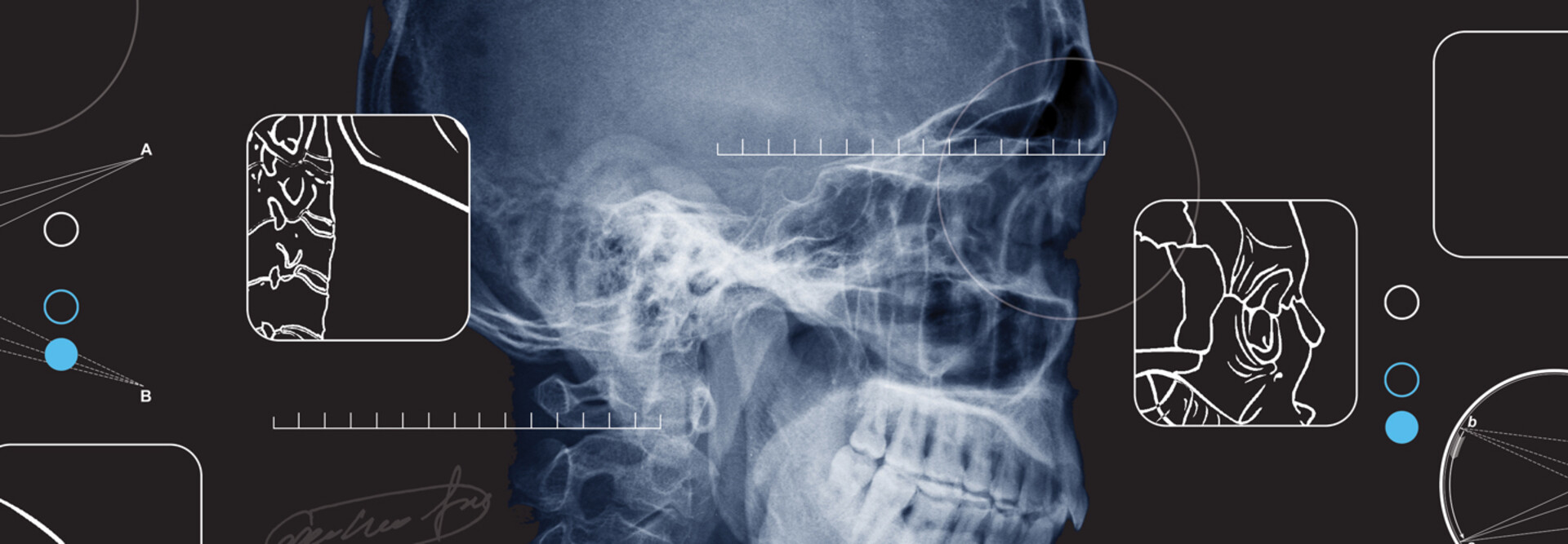 Comment l'IA peut-elle aider à transformer la radiologie?