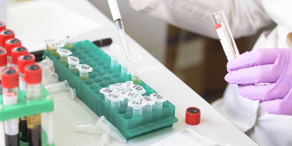 Comment les tests chimiques avancés transforment les diagnostics des soins de santé