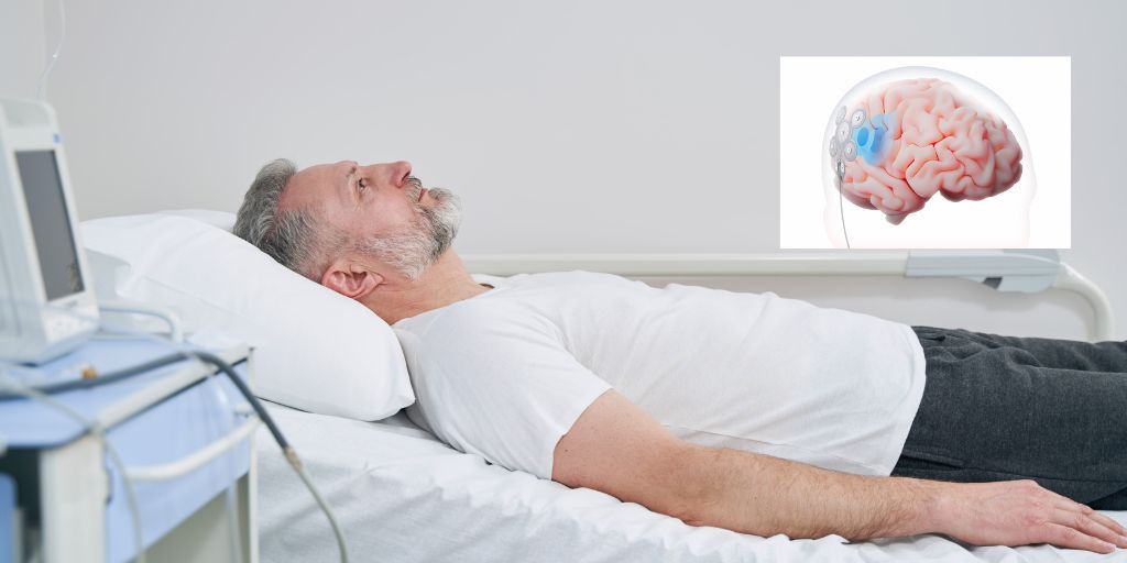 Lancement de l'étude clinique EASEE4YOU avec l'hôpital Great Ormond Street pour évaluer une thérapie de neurostimulation mini-invasive pour les adolescents atteints d'épilepsie pharmacorésistante