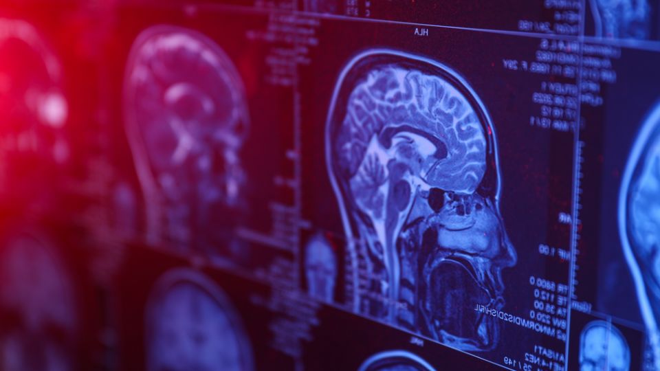 Le NHS Trust du United Lincolnshire Teaching Hospitals devient le premier au Royaume-Uni à installer la technologie de détection Canon Medical HD dans le cadre d'une mise à niveau évolutive de la radiologie interventionnelle