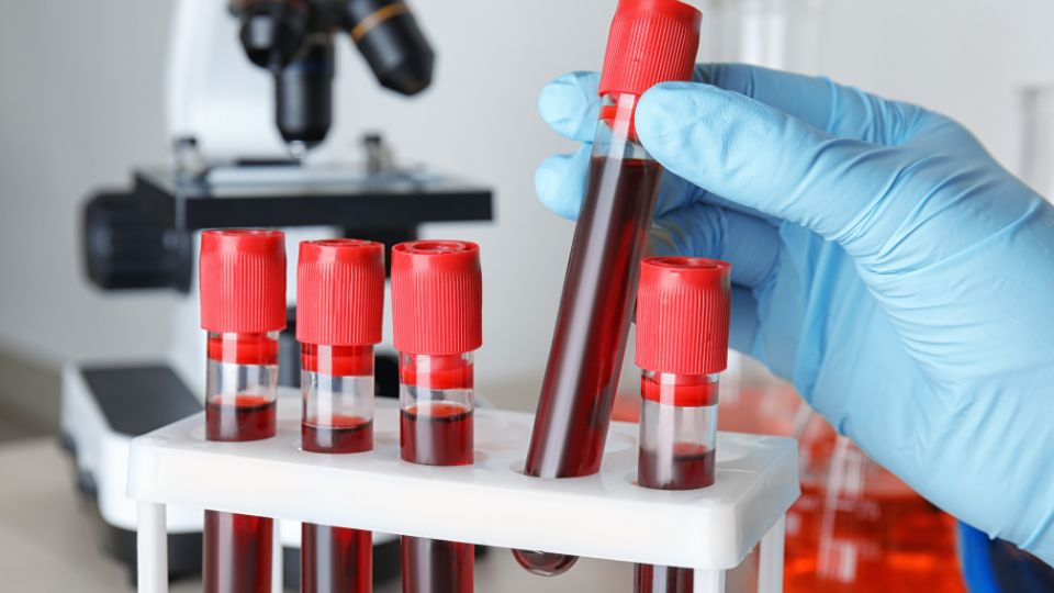 Une nouvelle recherche relie l'équilibre du NAD à l'inversion de la pathologie d'Alzheimer et à la récupération cognitive complète dans des modèles animaux