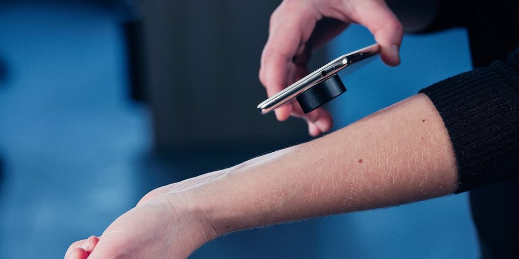 Une application smartphone pour le dépistage du cancer de la peau